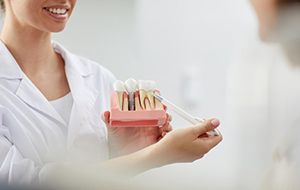 a dentist holding a model of a dental implant