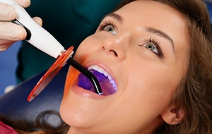 Woman receiving a tooth-colored filling in Canonsburg